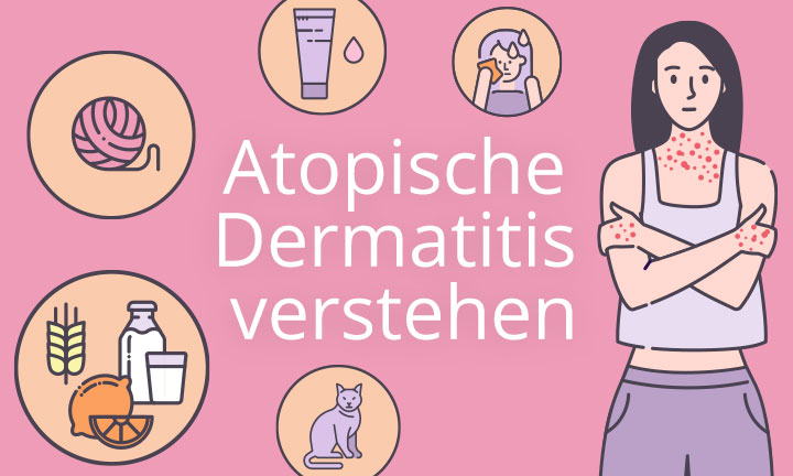 Atopische Dermatitis verstehen
