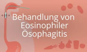 Behandlung von Eosinophiler Ösophagitis