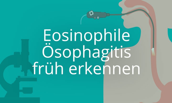 Eosinophile Ösophagitis früh erkennen