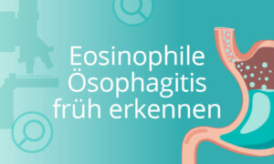 Eosinophile Ösophagitis früh erkennen