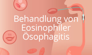 Behandlung von Eosinophiler Ösophagitis