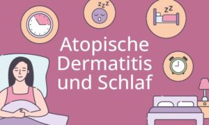 Kursbild Atopische Dermatitis und Schlaf