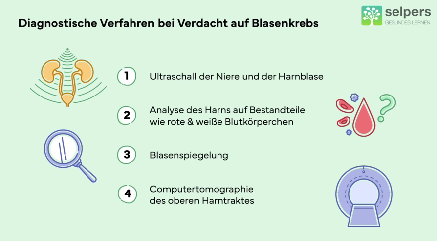 Diagnoseverfahren bei Verdacht auf Blasenkrebs