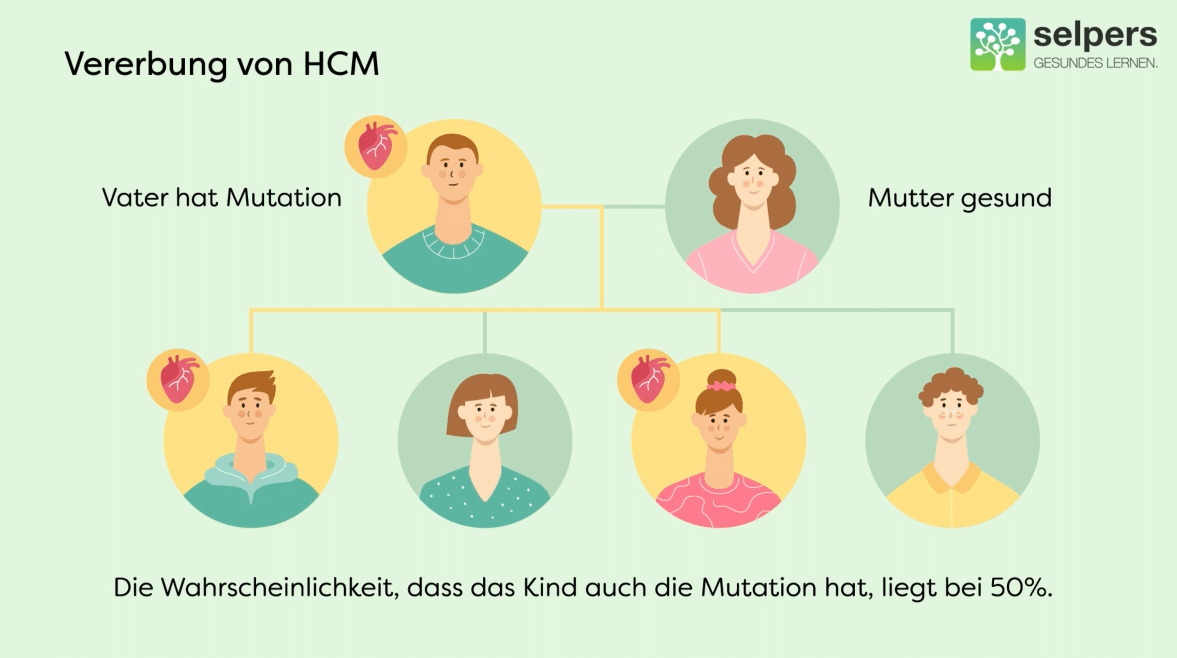 Vererbung von HCM: Stammbaum, ausgehende von Vater mit HCM-Mutation und gesunder Mutter. Daraus gehen vier weitere Äste hervor mit: Sohn mit Mutation, gesunder Tochter, Tochter mit Mutation und gesundem Sohn.